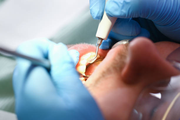 Best Emergency Treatment for Toothache in Coopersville, MI
