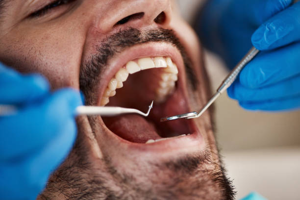 Best Emergency Wisdom Teeth Removal in Coopersville, MI