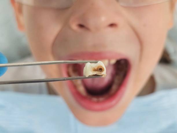 Best After-Hours Emergency Dentist in Coopersville, MI