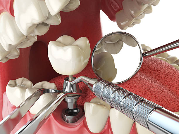 Best Emergency Treatment for Toothache in Coopersville, MI